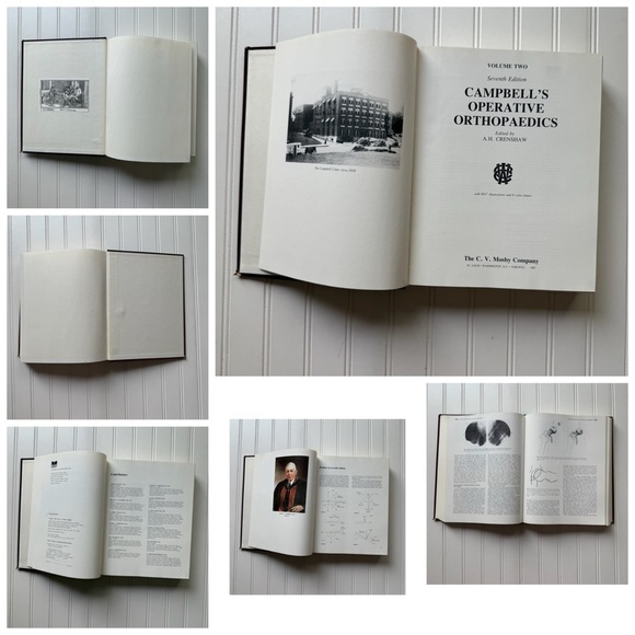 Seventh Edition Campbell’s Operative Orthopedics By A.H. Crenshaw Volume Two - Picture 4 of 6